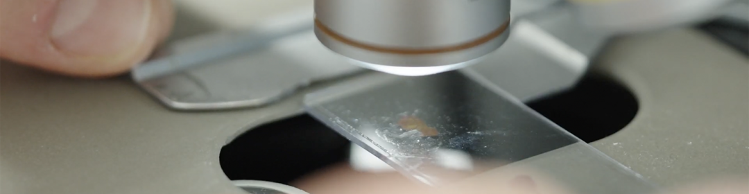 Betere bestraling van binnenuit